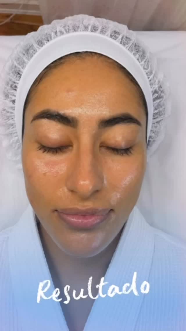 Luxury Hydration Facial by Angela Hernandez